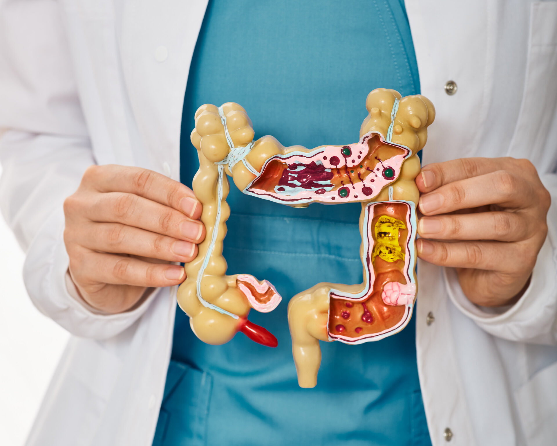 Colon irritable: síntomas, diagnóstico y tratamiento según un especialista